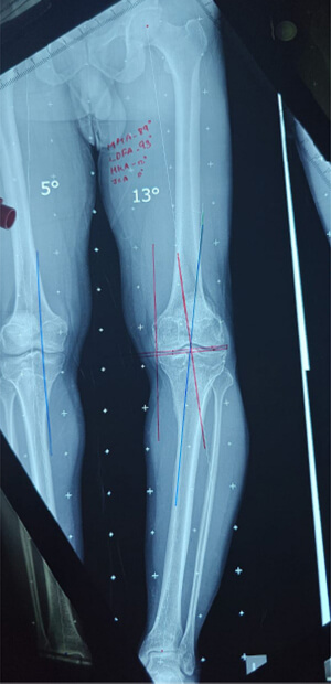 DEFORMITY CORRECTION
